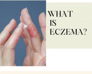 humidifier-for-eczema